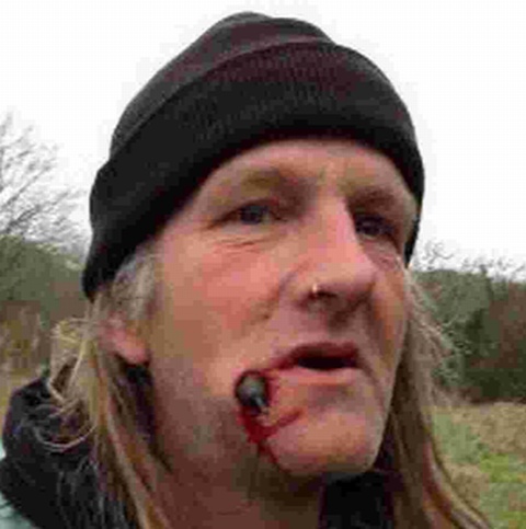 HOOKED: Angler Steve Redhead with the fishing weight lodged in his face - 2335252